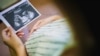 Žena gleda fotografiju bebe sa ultrazvuka, 2021.