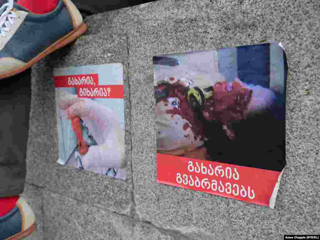 Плакати перед будівлею парламенту в Тбілісі. Протестувальники зазначають, що зображення праворуч показує демонстранта, якому ввечері 20 червня влучила в око гумова куля 
